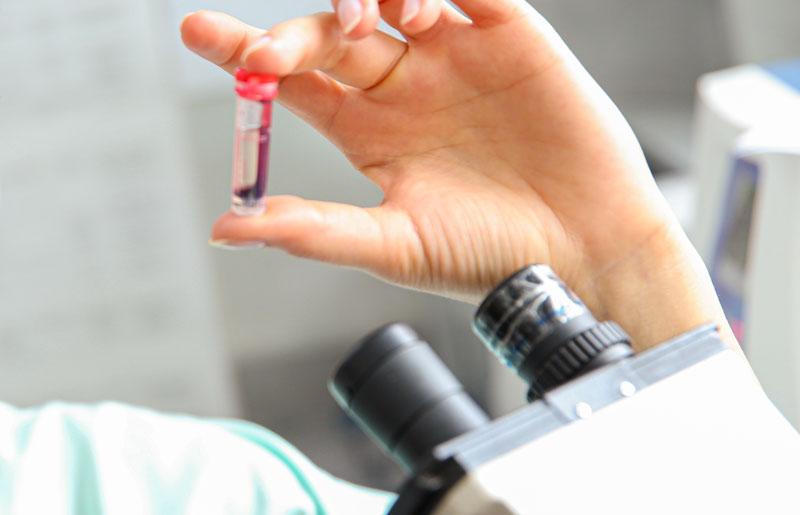 La babesia può essere rilevata nel sangue